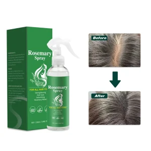 Private Label Natural Anti Hair Loss Rosemary Essential Oil Hair Growth Spray for All Hair Types