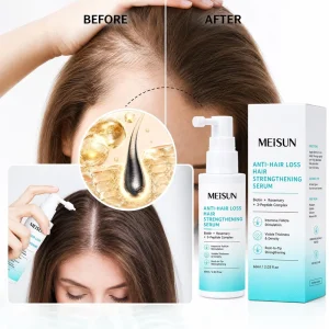 Private Label Natural Biotin Rosemary Anti Hair Loss Nourishing Hair Growth Serum Strengthening Hair Loss Growth Serums