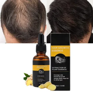 Private Label Natural Hair Growth Serum Regrowth Essence Women Men’s Hair Treatment Care Products Hair Growth Essential Oil OEM