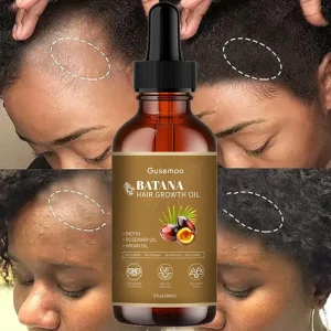 Private Label Natural Organic Batana Hair Essential Oil Serum Fast Anti Loss and Regrowth Treatment with Biotin for Hair Growth
