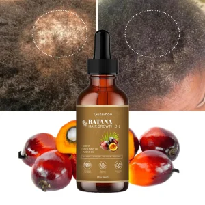 Private Label Natural Organic Batana Hair Growth Oil Serum Fast Anti-Loss and Regrowth Treatment with Biotin for Men and Women