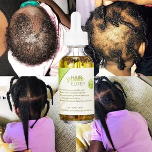 Private Label Natural Organic Rosemary Herbs Hair Oil Scalp Treatment Fast Regrowth Hair Growth Oil