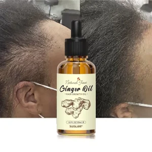 Private Label Natural Organic Scalp Vegan Black Hair Care Loss Treatment Ginger Hair Growth Oil Serum