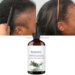 Private Label Nourishing Hair Repairing Growth Scalp Care Rosemary Essential Oil for Pure Natural Hair Oil Rosemary