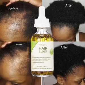 Private Label OEM 100% Natural Formula Nourishing Hair Care Loss Treatment Hair Growth Oil Serum