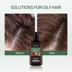 Private Label Oil Control Nourishing Repairing Hair Care Set Hair Growth Natural Shampoo and Conditioner Set