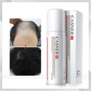 Private Label Organic Anti Hair Loss Oil Spray Thinning Hair Growth Serum for Hair Loss Treatment