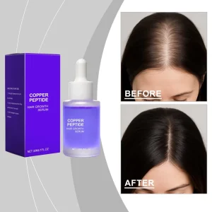 Private Label Organic Ginger Hair Treatment Serum Fast Hair Growth Oil Herbal Anti-Dandruff Nourishing Oil-Control Hair Loss
