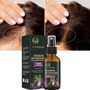 Private Label Organic Hair Growth Regrowth Oil Spray Anti Loss Serum for Men Hair Growth Supplement