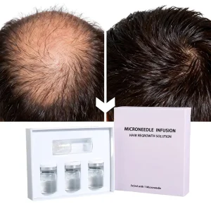 Private Label Organic Herbal Biotin Hair Growth Serum with Rosemary Scalp Treatment for Anti-Loss & Softening Hair
