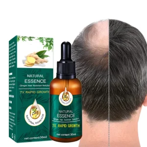 Private Label Organic Man Woman Hair Loss Care Treatment Products Vegan Ginger Hair Serum Nutrition Solution Hair Growth Oil