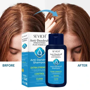 Private Label Organic Nourish Growth Anti Dandruff Shampoo for Hair Loss