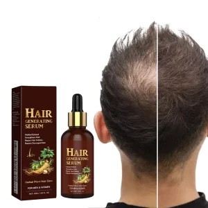 Private Label Plant Extract Serum Growth Hair Treatment Keratin Repair Scalp Care Hair Growth Oil Serum