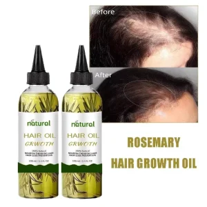 Private Label Rosemary Hair Growth Oil Natural Vegan Enhance Density Improve Follicle Vitality Hair Loss Treatment