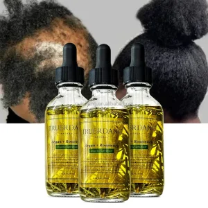 Private Label Rosemary Oil for Hair Growth Healthy Scalp Biotin Nourishing Hair Growth Serum Strengthening Hair Treatment Oils