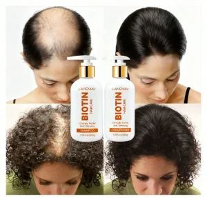 Private Label Vegan Hair Care Shampoo Conditioner Regrowth Thinning Hair Thickening Biotin Hair Growth Shampoo Sulfate Free