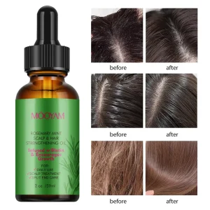 Private Label Vegan Hair Growth Oil Biotin and Rosemary Essential Oils Moisturizing Scalp Repair Care with Mint and Rosemary