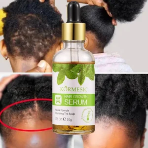 Private Labels OEM Organic Serum Hair Growth Oil for Men and Women Hair Serum