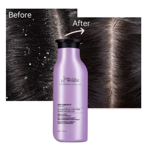 Professional Fluffy Anti dandruff Voluminous & Smooth Shampoo with Salicylic Acid for Curly Hair Liquid Formula Unisex Adult