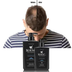 Professional Rapid Hair Growth Rosemary Oil Hair Shampoo and Conditioner Product Set