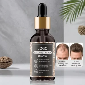 Professional Scalp Nutrition Essence Repair Damaged Hair Moisturizing Serum Boosts Hair Volume for All Hair Types