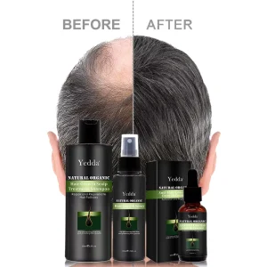 Professional Source Factory Natural Organic 200ml Hair Growth Shampoo for Treating Anti Hair Loss and Hair Growth