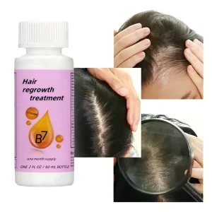 Quick Acting 2% Tea Tree Oil Hair Regrowth Treatment Concentrated for Female Hair