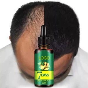 Ready made Pure Ginger Essential Oil Improving Hair Growth Anti Hair Loss Treatment for Men