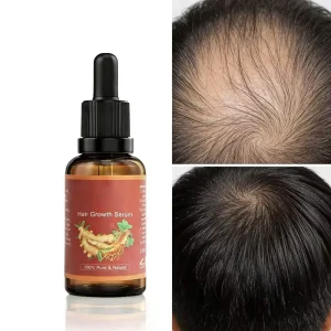 Reduce Hair Loss Serum Croissance De Cheveux Coconut Ginger Activate Hair Follicles Argan Repair Hair Growth Oil