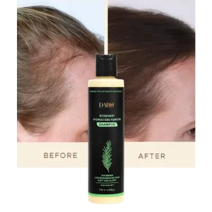 Rosemary Hair Growth Shampoo Gel Anti Frizz Smoothing Nourish Scalp Prevent Hair Loss Thicker Hair