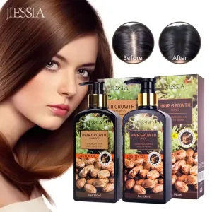 Scalp Care Regrowth Repair Damaged Anti Dandruff Castor Oil Anti Loss Natural Hair Growth Shampoo and Conditioner