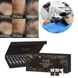 Scalp Hair Growth Micropigment Hair Regrowth Tonics Hair Treatment