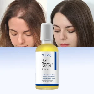 Sensitive Scalp Care Hair Regrowth Solution Hair Serum That Works for Receding Hairline