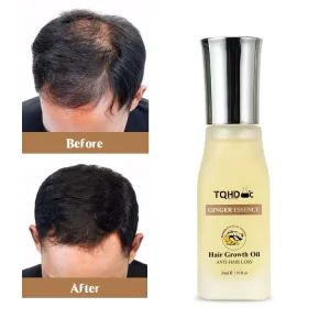 Serum Natural Ginger Germinal Hair Regrowth Treatment Anti Hair Loss Growth Serum Oil for Men Women