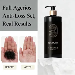 Shampoo Natural Hair Grow Shampoo Anti Hair Loss Shampoo hair loss treatment