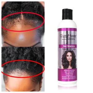 Smoothing Moisturizing Hair Lotion Hair Shampoo Products for Repair Hair Regrowth Anti Loss