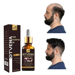 Strong Healthy Hair Treatment Scalp OEM ODM Regrowth Oil Hair Care for Men Hair Growth Oil Serum
