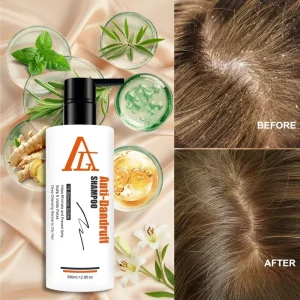 Tea Tree Oil Anti Dandruff Shampoo Organic Botanical Extracts Scalp Treatment for Itchy Scalp and Natural Flake Free Hair