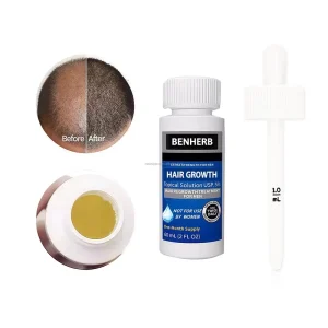 The Best Hair Loss Treatment for Men Boost Hair Growth by 5% Natural Hair Care Enhance Hair Follicle Vitality