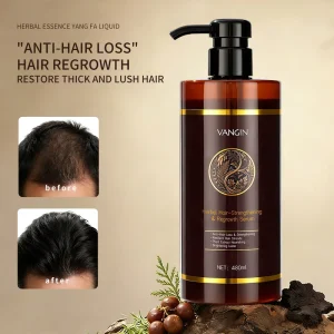 Unisex Adult Hair Serum for Hair Loss Prevention & Alopecia Treatment Hair Growth & Regrowth Tonic