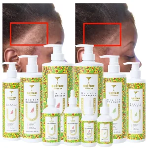 Your Own Brand ORGANIC Shampoo OEM Coconut Oil Biotin Shampoo and Conditioner Hair Care Set for Hair Growth